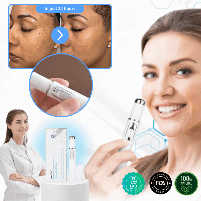 🔥 Laser Pen 🔥 Removes Warts & Moles in Just 2 Days!