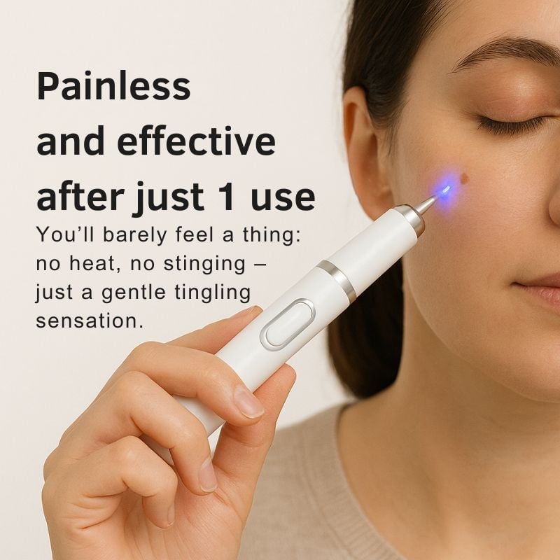🔥 Laser Pen 🔥 Removes Warts & Moles in Just 2 Days!