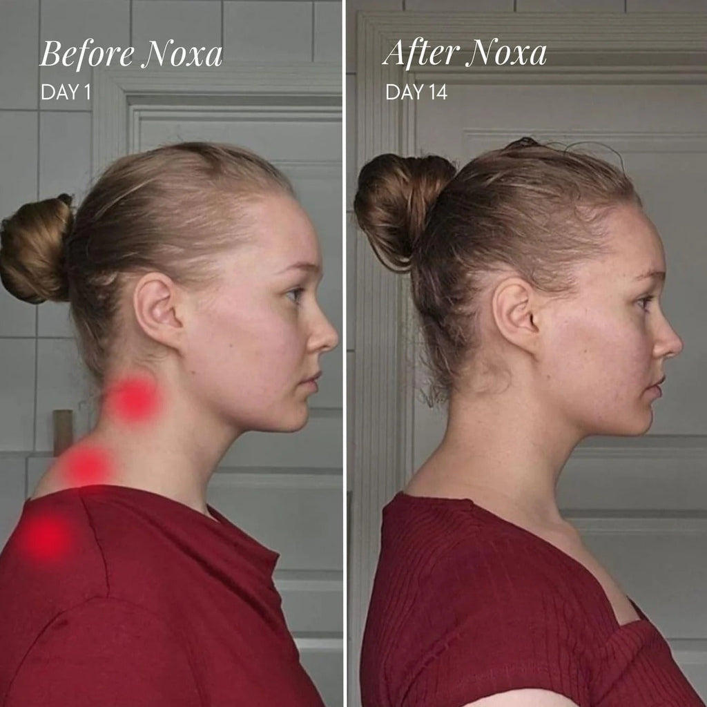 Neck & Shoulder Massager – Smart Deep Tissue Relaxation Device